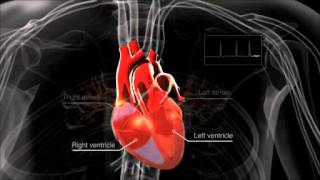 What is atrial fibrillation [upl. by Yuria]