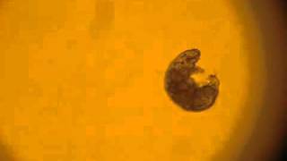 Het dappere beerdiertje  A Water Bear tardigrade from my backyard pond water [upl. by Whang]