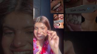 Trying tooth gem for the first time shorts ytshorts grwm toothgems [upl. by Erle]