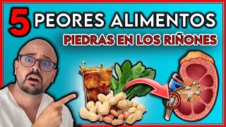 5 ALIMENTOS que producen PIEDRAS en los RIÑONES  ¡EVITALOS si tienes INSUFICIENCIA RENAL [upl. by Enimasaj]