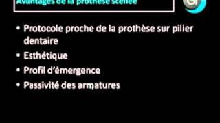 Implant dentaire  Quand réaliser de la prothèse scellée [upl. by Rozek]