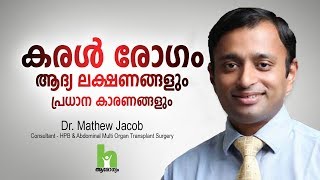 കരൾ രോഗത്തിന്റെ ഈ ലക്ഷണങ്ങൾ സൂക്ഷിക്കുക  Liver Disease Malayalam Health Tips [upl. by Darya]