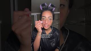 GRWM scalp eczema  eczema scars [upl. by Eremaj]