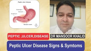 Peptic Ulcer Disease Duodenal Ulcer amp Homeopathic treatment pepticulcerstomachulcer [upl. by Olmsted112]