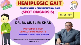 NS17Hemiplegic Gait  Spot DiagnosisFeaturesTypesSites of Lesion of HemiplegiaDr Muslim Khan [upl. by Evatsug713]