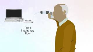 Easyhaler dry powder inhaler in patients with COPD [upl. by Seiden]