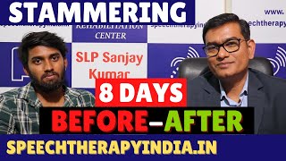 SLP Sanjay Kumar BeforeAfter Stammering Speech Therapy  Bangalore  Speech Pathologist India [upl. by Lucais]