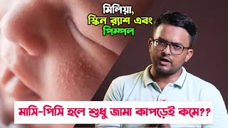 সদ্যজাতদের মাসি পিসি আসলে কি  হলে কি করা উচিৎ  ডাক্তার কখন দেখাবেন । Milia  Milk Spot  Pimple [upl. by Alemac]