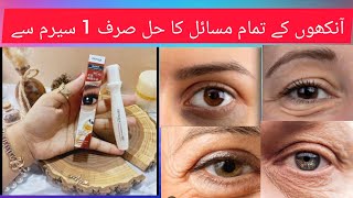 How to Treatment Dark circle Puffy eyes Eyes wrinkles and eye dryenss [upl. by Dier]