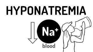 HYPONATREMIA made easy [upl. by Norabal]