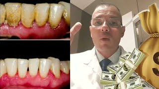 QUANTO CUSTA UMA LIMPEZA DENTÁRIA Não Seja Enganado [upl. by Neyr]