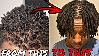 How I Got The Best Freeform Locs Ever 1 Year Dreadlock Journey [upl. by Ailev]