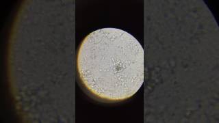 mold under microscope 1 HD [upl. by Suzzy]