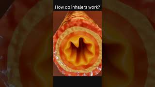 How do inhalers work [upl. by Jarietta]