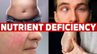 13 Signs Your Body is Deficient in Nutrients [upl. by Anayrb]