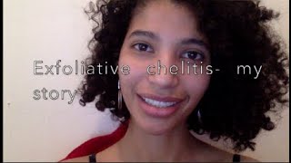 Exfoliative cheilitis lip condition and products to control it my story [upl. by Ahasuerus18]