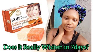 KOJIC WHITE KOJIC ACID AND PAPAYA BRIGHTENING LOTION FULL REVIEW BEFORE VS AFTER [upl. by Dyna]