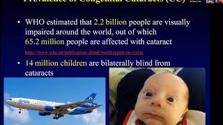 Lecture Congenital Cataracts What Do You Need to Know [upl. by Sublett]