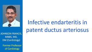 Infective endarteritis in patent ductus arteriosus [upl. by Adnyl]