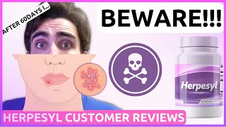 HERPESYL REVIEW  ALERT  Herpesyl Reviews  Herpesyl Customer Reviews  Herpesyl Herpes Supplement [upl. by Ennazzus857]