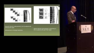 Spinal Cord Ischemia with Endovascular Treatment of Thoracoabdominal Aortic Aneurysms [upl. by Ikcim891]