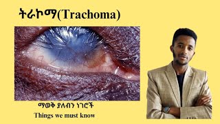 ለአይነ ስውርነት የሚዳርገው ትራኮማ Trachoma and its laboratory diagnosis Dr seife donkeytube Tenamedia [upl. by Uchida849]