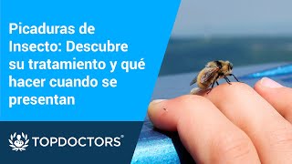 Picaduras de Insecto Descubre su tratamiento y que hacer cuando se presentan [upl. by Palmira]