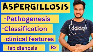 Aspergillosis microbiologymorphologypathogenesislabdiagnosisTreatment [upl. by Friedrick596]