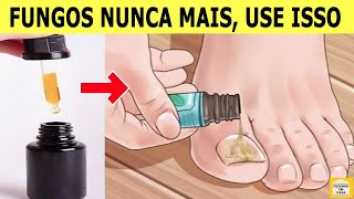 👣REMOVE FUNGOS SÓ 3 Gotas Deste Óleo Para Eliminar os FUNGOS DAS UNHAS em Poucos Dias [upl. by Pierson866]