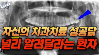 사랑니 자가치아이식 6년 후 다른 치과에서 뽑고 임플란트 하라던 어금니 신경치료 후 살려낸 6년 후 모습 치과치료 치과의사 [upl. by Lisab]