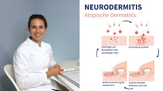 Neurodermitis  Ärztin erklärt worauf man achten sollte [upl. by Nirok525]