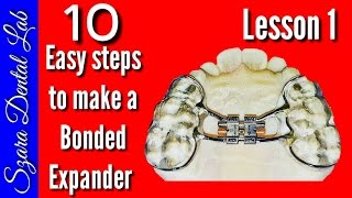 How to make a Orthodontic Bonded palatal expander [upl. by Ecille]