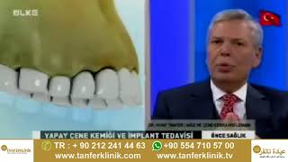 Diş eti çekilmesi nedir  Diş kayıpları için implant tedavisi nasıl olur  DrNihat Tanfer [upl. by Mommy]