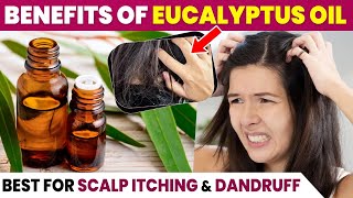 How to use Eucalyptus Oil  Eucalyptus Oil for Hair Growth [upl. by Adnulahs]