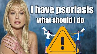 Defeat Psoriasis with THESE 3 Simple Steps [upl. by Aniakudo961]