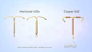 What is an IUD [upl. by Nitsyrk]