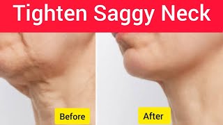 3 min To Tighten Saggy Neck With These Exercises Natural Tips [upl. by Ecnirp17]