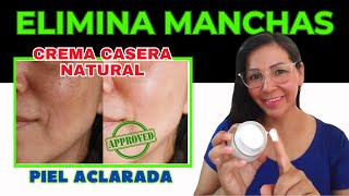 Crema casera para las manchas de la cara [upl. by Pierrepont]