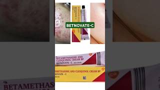 BETNOVATEC Cream use amp side effects squalane shortsfeed shorts beautycream facecreamfungal [upl. by Atel]