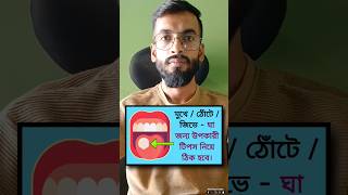 Mouth Ulcers Treatment at home remedies youtubeshorts [upl. by Ikcim]