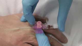 Cannulation How to gain IV access [upl. by Bast600]