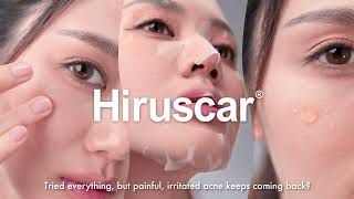 Hiruscar AntiAcne Advanced Spot Gel 15s [upl. by Ayekram]