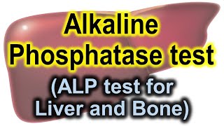 Alkaline phosphatase test  ALP test for liver and bones  ALP test [upl. by Pettiford]