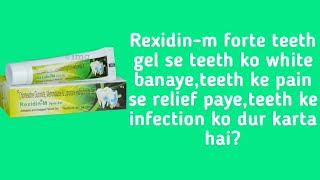 Rexidinm forte teeth gel review [upl. by Aksehcnarf]