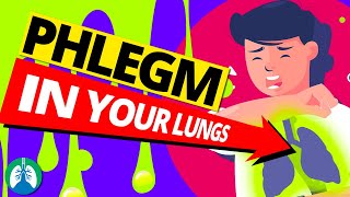 Top 10 Ways to Get Rid of Constant Mucus and Phlegm in Your Throat [upl. by Eruot]