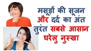 मसूड़ो की सूजन और दर्द का अंत तुरंत masudo ki sujan ka ilaj gum pain and swelling problem solution [upl. by Erina]