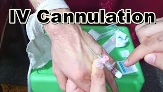 How to Insert IV Cannula  IV Cannulation Technique  Branula  Intravenous Catheter [upl. by Vaclav970]