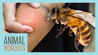 What You Need To Know About Bee Stings [upl. by Iew]