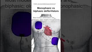 Monophasic vs biphasic defibrillators [upl. by Lehctim]