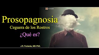 Ceguera de los Rostros Prosopagnosia ¿Qué es [upl. by Medlin134]